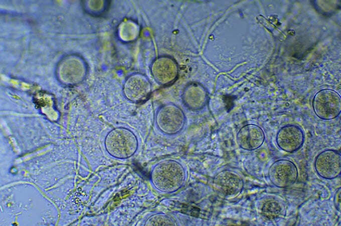 Descubren la &ldquo;c&aacute;psula de escape&rdquo; de las bacterias que podr&iacute;a ayudar a combatir las resistentes a los antibi&oacute;ticos